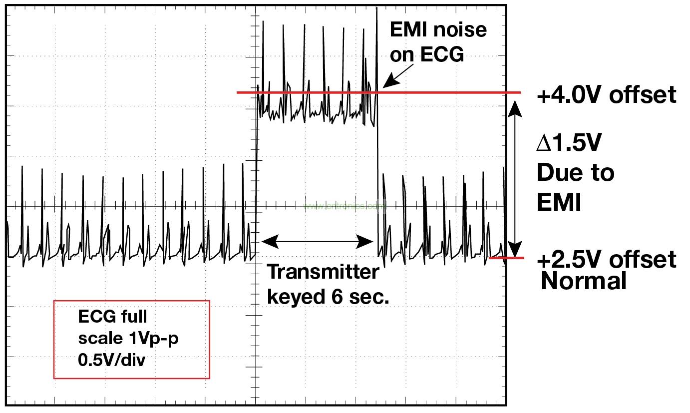 圖 1    1.5 英尺以外的發(fā)射器（f = 470 MHz, P= 0.5W）開啟和關(guān)閉時 ECG 診斷設(shè)備的心臟檢查結(jié)果