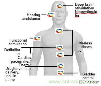 植入無線電應用示例