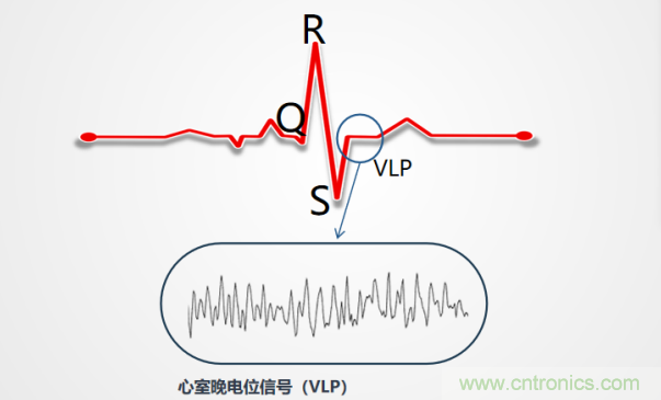 解決心電監(jiān)測(cè)行業(yè)難題，曼森伯格的濾波技術(shù)獲國(guó)家知識(shí)產(chǎn)權(quán)局發(fā)明授權(quán)